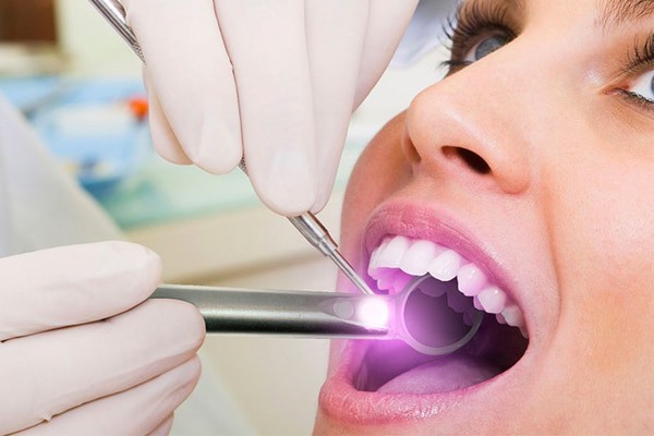 Regular oral cancer screenings are an important part of preventive dental care. Gentle Dental Check-Ups in Central Coast and Umina Beach Oral Cancer Screening
